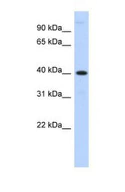 MPPE1 Antibody, Novus Biologicals 0.05mg; Unlabeled:Antibodies, Polyclonal