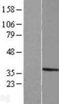 Novus Biologicals&trade;&nbsp;MPPED2 Overexpression Lysate