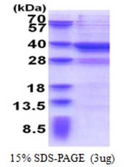 Novus Biologicals&trade;&nbsp;Recombinant Human MPPED2 His Protein