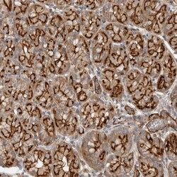 MPRIP Antibody, Novus Biologicals 25 &mu;L; Unlabeled:Antibodies, Polyclonal