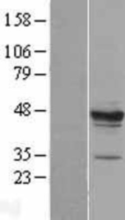 Novus Biologicals™ MPST Overexpression Lysate