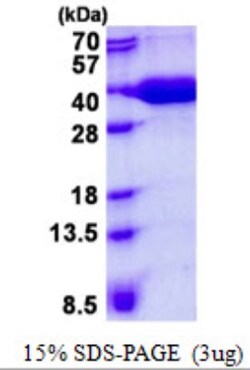 Novus Biologicals&trade;&nbsp;Recombinant Human MPST His Protein