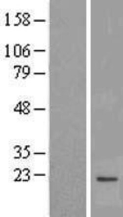 Novus Biologicals™ MPV17 Overexpression Lysate
