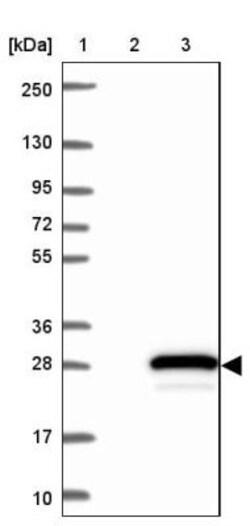 MPV17L2 Antibody, Novus Biologicals 0.1mL; Unlabeled:Antibodies, Polyclonal