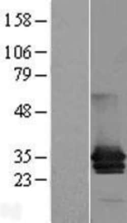 Novus Biologicals&trade;&nbsp;MPZL1 Overexpression Lysate