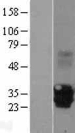 Novus Biologicals™ EVA1/MPZL2 Overexpression Lysate