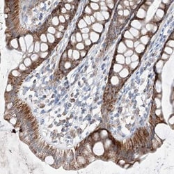 MRAP Antibody, Novus Biologicals:Antibodies:Primary Antibodies