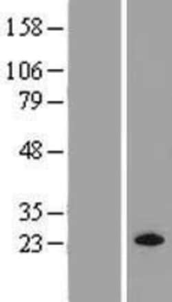 Novus Biologicals&trade;&nbsp;M-Ras/R-Ras3 Overexpression Lysate