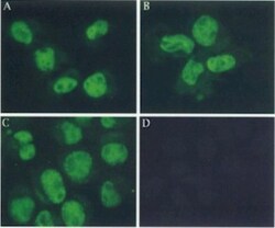 Mre11 Antibody (12D7), Novus Biologicals 0.1mg; Unlabeled:Antikörper