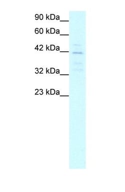 MRG15 Antibody, Novus Biologicals 100&mu;L; Unlabeled:Antibodies, Polyclonal