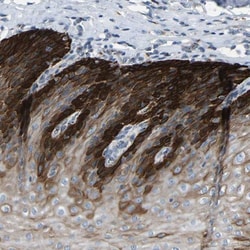 CYREN Antibody, Novus Biologicals 25 &mu;L; Unlabeled:Antibodies, Polyclonal