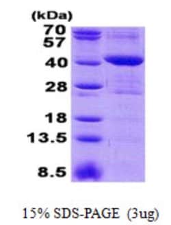 Novus Biologicals&trade;&nbsp;Recombinant Human MRM1 His Protein