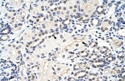 MRM1 Antibody, Novus Biologicals 100&mu;L; Unlabeled:Antibodies, Polyclonal