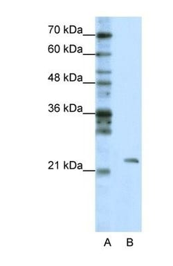 MRM1 Antibody, Novus Biologicals 100&mu;L; Unlabeled:Antibodies, Polyclonal