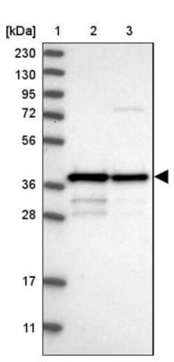 MRM1 Antibody, Novus Biologicals 25 &mu;L | Buy Online | Novus Biologicals | Fisher Scientific