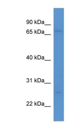 MRO Antibody, Novus Biologicals:Antibodies:Primary Antibodies