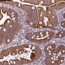 MRP63 Antibody, Novus Biologicals:Antibodies:Primary Antibodies