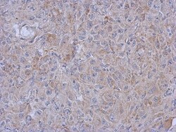 MRPL10 Antibody, Novus Biologicals 0.1mL; Unlabeled:Antibodies, Polyclonal