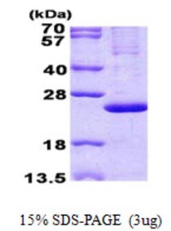Novus Biologicals&trade;&nbsp;Recombinant Human MRPL13 His Protein