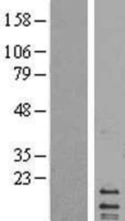 Novus Biologicals&trade;&nbsp;MRPL14 Overexpression Lysate