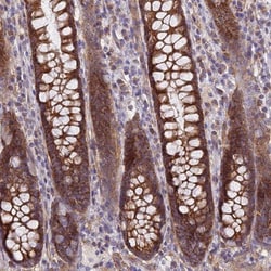 MRPL15 Antibody, Novus Biologicals 0.1mL; Unlabeled:Antibodies, Polyclonal