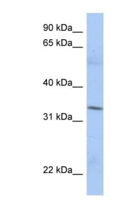 MRPL15 Antibody, Novus Biologicals:Antibodies:Primary Antibodies