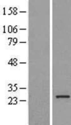 Novus Biologicals&trade;&nbsp;MRPL16 Overexpression Lysate