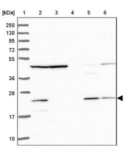 MRPL17 Antibody, Novus Biologicals 0.1mL; Unlabeled:Antibodies, Polyclonal