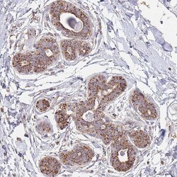 MRPL17 Antibody, Novus Biologicals 0.1mL; Unlabeled:Antibodies, Polyclonal