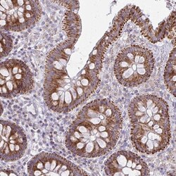 MRPL19 Antibody, Novus Biologicals 0.1mL; Unlabeled:Antibodies, Polyclonal