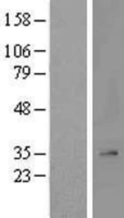 Novus Biologicals™ MRPL2 Overexpression Lysate