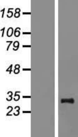 Novus Biologicals&trade;&nbsp;MRPL24 Overexpression Lysate