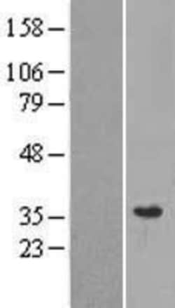 Novus Biologicals&trade;&nbsp;MRPL28 Overexpression Lysate