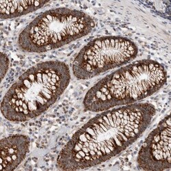 MRPL37 Antibody, Novus Biologicals 25 &mu;L | Buy Online | Novus Biologicals | Fisher Scientific