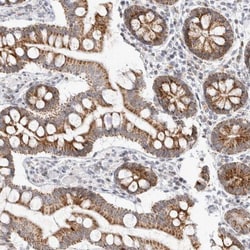 MRPL37 Antibody, Novus Biologicals 0.1mL; Unlabeled:Antibodies, Polyclonal