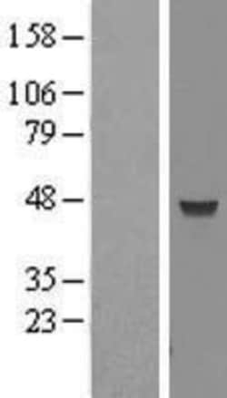 Novus Biologicals&trade;&nbsp;MRPL38 Overexpression Lysate