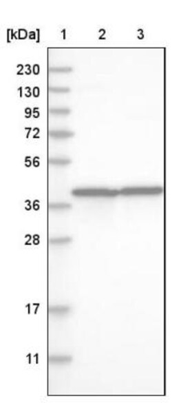 MRPL38 Antibody, Novus Biologicals 0.1mL; Unlabeled:Antibodies, Polyclonal