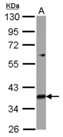 MRPL39 Antibody, Novus Biologicals 0.1mL; Unlabeled:Antibodies, Polyclonal