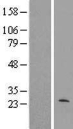 Novus Biologicals&trade;&nbsp;MRPL40 Overexpression Lysate