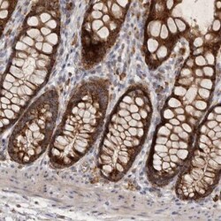MRPL41 Antibody, Novus Biologicals:Antibodies:Primary Antibodies