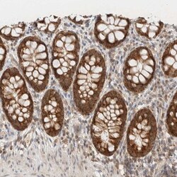 MRPL41 Antibody, Novus Biologicals:Antibodies:Primary Antibodies