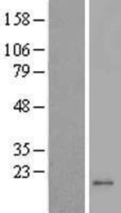 Novus Biologicals&trade;&nbsp;MRPL42 Overexpression Lysate