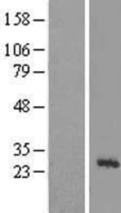 Novus Biologicals™ MRPL43 Overexpression Lysate