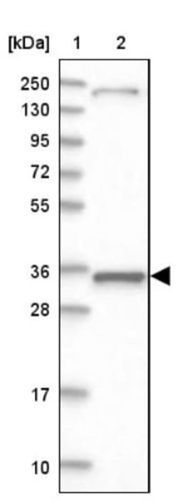 MRPL44 Antibody, Novus Biologicals 0.1mL; Unlabeled:Antibodies, Polyclonal
