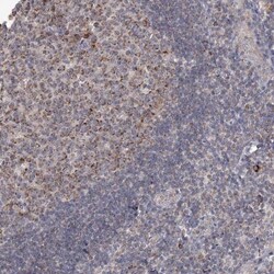 MRPL44 Antibody, Novus Biologicals 0.1mL; Unlabeled:Antibodies, Polyclonal
