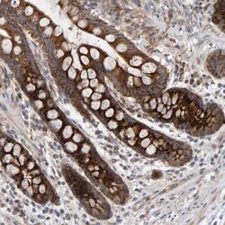 MRPL45 Antibody, Novus Biologicals 0.1mL; Unlabeled:Antibodies, Polyclonal