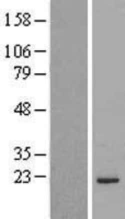 Novus Biologicals™ MRPL48 Overexpression Lysate