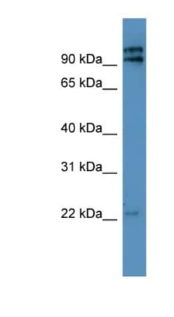 MRPL49 Antibody, Novus Biologicals 100&mu;L; Unlabeled:Antibodies, Polyclonal