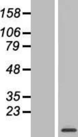 Novus Biologicals&trade;&nbsp;MRPL52 Overexpression Lysate