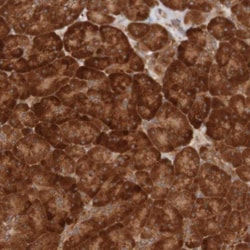 MRPL52 Antibody, Novus Biologicals:Antibodies:Primary Antibodies